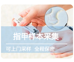 指甲样本采样方法步骤